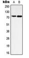 Protein Tyrosine Phosphatase Non-Receptor Type 11 antibody, orb223993, Biorbyt, Western Blot image 