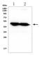 Keratin 20 antibody, A02828-2, Boster Biological Technology, Western Blot image 