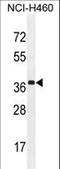 Zinc Finger CCCH-Type Containing 15 antibody, LS-C160736, Lifespan Biosciences, Western Blot image 