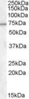 Methylphosphate Capping Enzyme antibody, PA5-18813, Invitrogen Antibodies, Western Blot image 