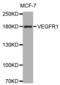 Fms Related Tyrosine Kinase 1 antibody, TA332785, Origene, Western Blot image 