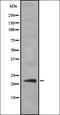 Cytochrome P450 Family 4 Subfamily F Member 3 antibody, orb337723, Biorbyt, Western Blot image 