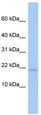 SH3 Domain Binding Glutamate Rich Protein Like antibody, TA346575, Origene, Western Blot image 