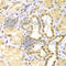 S100 Calcium Binding Protein A11 antibody, A5486, ABclonal Technology, Immunohistochemistry paraffin image 