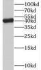 RNA Binding Motif Protein 17 antibody, FNab07167, FineTest, Western Blot image 