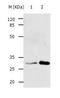 Tyrosine 3-Monooxygenase/Tryptophan 5-Monooxygenase Activation Protein Beta antibody, TA322851, Origene, Western Blot image 