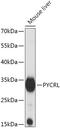 Pyrroline-5-Carboxylate Reductase 3 antibody, 18-092, ProSci, Western Blot image 