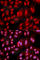 Protein Phosphatase 2 Regulatory Subunit Balpha antibody, A2185, ABclonal Technology, Immunofluorescence image 