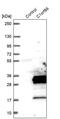 FA Core Complex Associated Protein 20 antibody, PA5-58555, Invitrogen Antibodies, Western Blot image 
