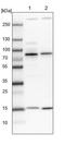 Ankyrin Repeat Domain 13A antibody, PA5-58812, Invitrogen Antibodies, Western Blot image 