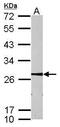 Metabolism Of Cobalamin Associated B antibody, PA5-28499, Invitrogen Antibodies, Western Blot image 