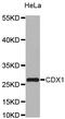 G Protein-Coupled Receptor Kinase 5 antibody, orb373171, Biorbyt, Western Blot image 
