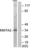 Chromosome 1 Open Reading Frame 35 antibody, GTX87017, GeneTex, Western Blot image 