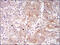 BLNK antibody, M03630-1, Boster Biological Technology, Immunohistochemistry paraffin image 