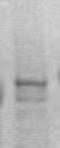 DBF4 Zinc Finger antibody, TA354621, Origene, Western Blot image 