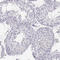 GHF1 antibody, HPA041646, Atlas Antibodies, Immunohistochemistry frozen image 