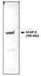 Structural maintenance of chromosomes protein 2 antibody, AM05324PU-N, Origene, Western Blot image 