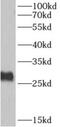 AKAP14 antibody, FNab00253, FineTest, Western Blot image 