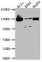 BUB1 Mitotic Checkpoint Serine/Threonine Kinase antibody, CSB-RA281837A0HU, Cusabio, Western Blot image 
