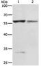 Prolylcarboxypeptidase antibody, orb107430, Biorbyt, Western Blot image 