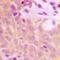BMX Non-Receptor Tyrosine Kinase antibody, orb393226, Biorbyt, Immunohistochemistry paraffin image 