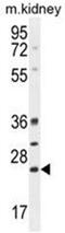 BCL10 Immune Signaling Adaptor antibody, AP50354PU-N, Origene, Western Blot image 