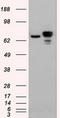 Catenin Beta 1 antibody, CF500049, Origene, Western Blot image 