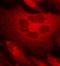 Renal carcinoma antigen NY-REN-26 antibody, orb14588, Biorbyt, Immunofluorescence image 