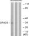 Olfactory Receptor Family 4 Subfamily C Member 6 antibody, LS-C120864, Lifespan Biosciences, Western Blot image 