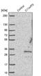 Cilia And Flagella Associated Protein 300 antibody, PA5-58452, Invitrogen Antibodies, Western Blot image 