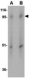 Zinc transporter ZIP10 antibody, GTX31968, GeneTex, Western Blot image 