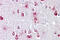 Protein Phosphatase Methylesterase 1 antibody, ARP56845_P050, Aviva Systems Biology, Immunohistochemistry paraffin image 