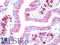 Galectin 3 Binding Protein antibody, LS-B9815, Lifespan Biosciences, Immunohistochemistry frozen image 