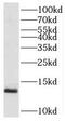 SEC61 Translocon Beta Subunit antibody, FNab07689, FineTest, Western Blot image 