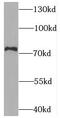 Syntaphilin antibody, FNab08443, FineTest, Western Blot image 