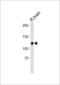 CASK antibody, LS-C204034, Lifespan Biosciences, Western Blot image 