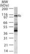 RB Transcriptional Corepressor 1 antibody, GTX13857, GeneTex, Western Blot image 