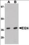 Etoposide-induced protein 2.4 antibody, orb95897, Biorbyt, Western Blot image 