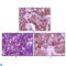 BLK Proto-Oncogene, Src Family Tyrosine Kinase antibody, LS-C812405, Lifespan Biosciences, Immunohistochemistry paraffin image 