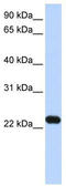 Late Endosomal/Lysosomal Adaptor, MAPK And MTOR Activator 5 antibody, TA340108, Origene, Western Blot image 