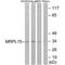 Mitochondrial Ribosomal Protein L15 antibody, A14077, Boster Biological Technology, Western Blot image 