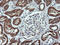 Acetyl-CoA Acyltransferase 2 antibody, LS-C338059, Lifespan Biosciences, Immunohistochemistry paraffin image 