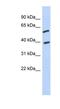 Family With Sequence Similarity 217 Member A antibody, NBP1-91462, Novus Biologicals, Western Blot image 