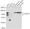 UDP Glucuronosyltransferase Family 2 Member B10 antibody, A08993, Boster Biological Technology, Western Blot image 