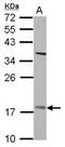 Patatin-like phospholipase domain-containing protein 4 antibody, NBP2-19878, Novus Biologicals, Western Blot image 
