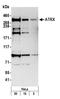 ATRX Chromatin Remodeler antibody, A301-045A, Bethyl Labs, Western Blot image 