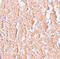 Zinc transporter ZIP10 antibody, 6099, ProSci Inc, Immunohistochemistry paraffin image 