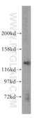 RNA Polymerase III Subunit B antibody, 16574-1-AP, Proteintech Group, Western Blot image 