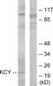 Cytidine/Uridine Monophosphate Kinase 1 antibody, LS-C118852, Lifespan Biosciences, Western Blot image 