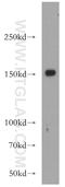 TATA Element Modulatory Factor 1 antibody, 19728-1-AP, Proteintech Group, Western Blot image 